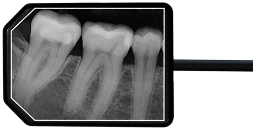 Ei-Dental-Sensors-Size2-Xray-Web