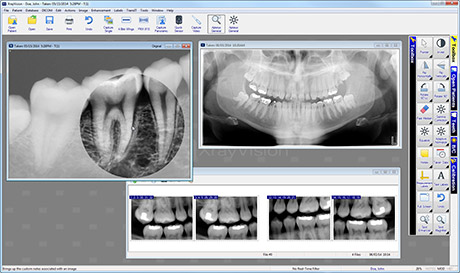 Apteryx XrayVision